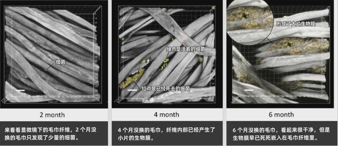 同面料毛巾！我们低价搞到了ky开元棋牌某东来刚上架的(图6)